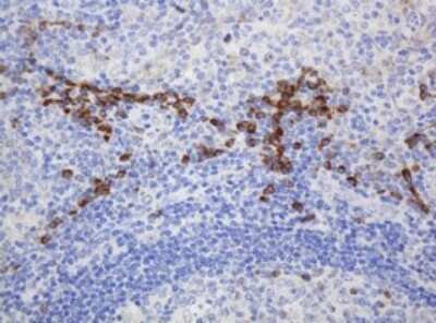 Immunohistochemistry: Ribophorin II Antibody (OTI1G9) [NBP2-45963]