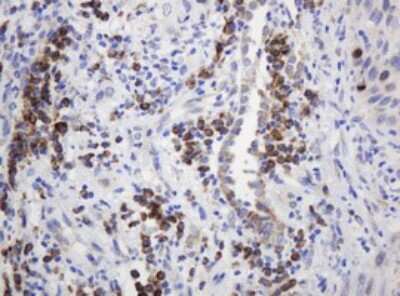 Immunohistochemistry: Ribophorin II Antibody (OTI1G9) [NBP2-45963]