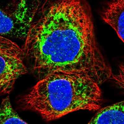 Immunocytochemistry/ Immunofluorescence: Ribophorin II Antibody [NBP1-80835]