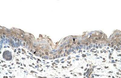 Immunohistochemistry-Paraffin: Ribophorin II Antibody [NBP1-62480]