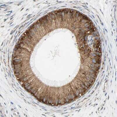 Immunohistochemistry-Paraffin: Ribophorin II Antibody [NBP1-80836]