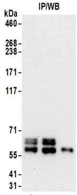 Immunoprecipitation: Ribophorin II Antibody [NBP2-32178]