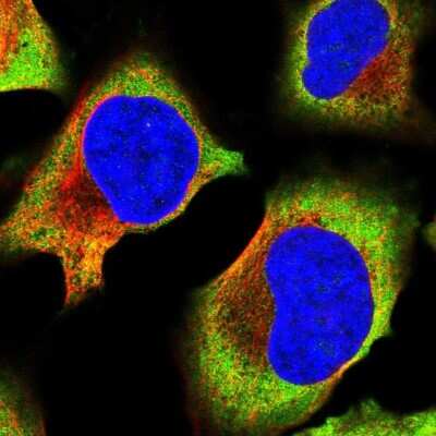 Immunocytochemistry/ Immunofluorescence: Ribosomal Protein L17 Antibody [NBP2-48845]