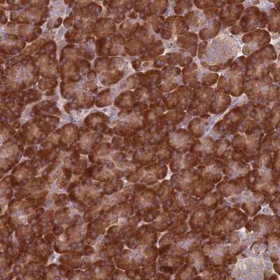Immunohistochemistry: Ribosomal Protein L17 Antibody [NBP2-48845]