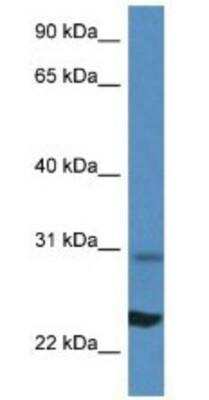 Western Blot: Ribosomal Protein L17 Antibody [NBP1-74075]