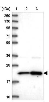 Western Blot: Ribosomal Protein L17 Antibody [NBP2-48798]