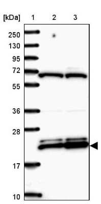 Western Blot: Ribosomal Protein L17 Antibody [NBP2-48845]