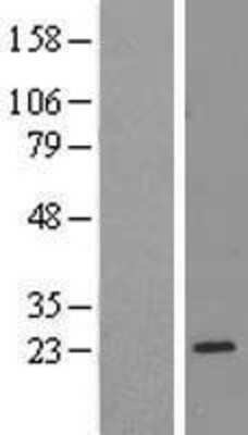 Western Blot: Ribosomal Protein L17 Overexpression Lysate [NBL1-15509]