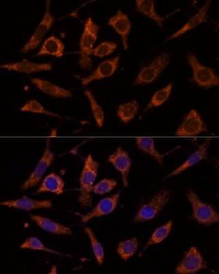 Immunocytochemistry/ Immunofluorescence: Ribosomal Protein L24 Antibody - Azide and BSA Free [NBP2-93788]