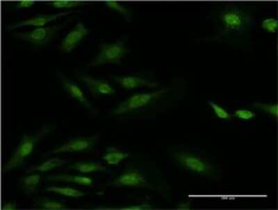 Immunocytochemistry/ Immunofluorescence: Ribosomal Protein S29 Antibody (3G9) [H00006235-M02]
