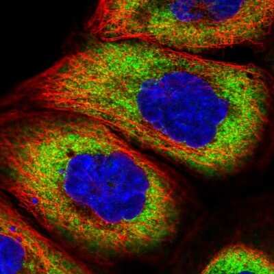 Immunocytochemistry/ Immunofluorescence: Ribosomal Protein S6/RPS6 Antibody [NBP1-87099]