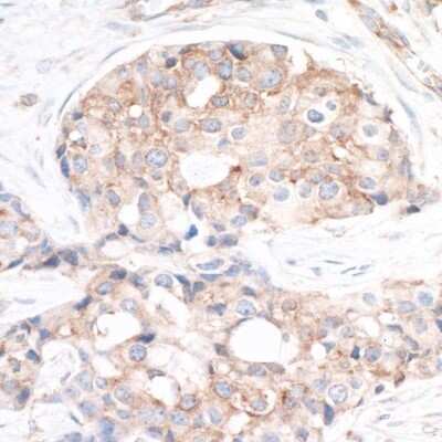 Immunohistochemistry-Paraffin: Ribosomal Protein S6/RPS6 Antibody [NB100-1595]