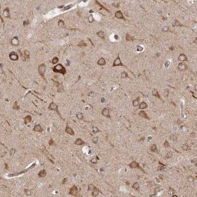 Immunohistochemistry-Paraffin: Ribosomal Protein S6/RPS6 Antibody [NBP1-87099]