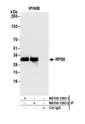 Immunoprecipitation: Ribosomal Protein S6/RPS6 Antibody [NB100-1595]