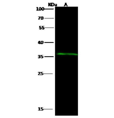Western Blot: Ribosome maturation protein SBDS Antibody [NBP2-98404]