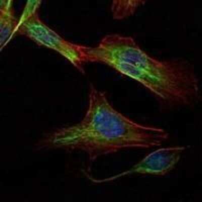 Immunocytochemistry/ Immunofluorescence: Rictor Antibody (7B3) - Azide and BSA Free [NBP2-80925]