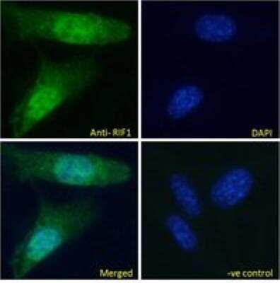 Immunocytochemistry/ Immunofluorescence: Rif1 Antibody [NBP2-26129]