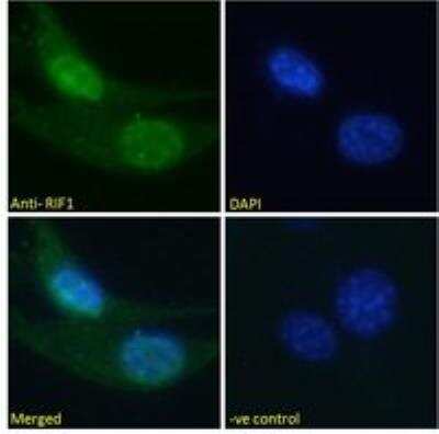 Immunocytochemistry/ Immunofluorescence: Rif1 Antibody [NBP2-26129]