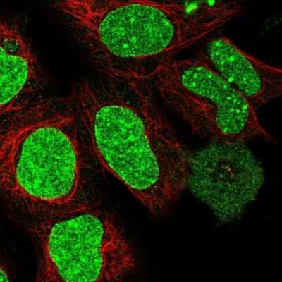 Immunocytochemistry/ Immunofluorescence: Rif1 Antibody [NBP2-47303]