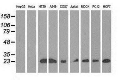 Western Blot: Rit2 Antibody (OTI3F4)Azide and BSA Free [NBP2-73917]