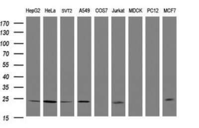 Western Blot: Rit2 Antibody (OTI4A6)Azide and BSA Free [NBP2-73914]