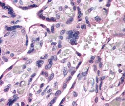 Immunohistochemistry: ROBO4 Antibody [NB110-58778]