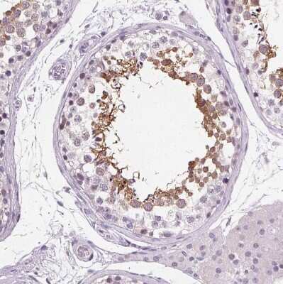 Immunohistochemistry-Paraffin: Ropporin 1-like Antibody [NBP2-47299]