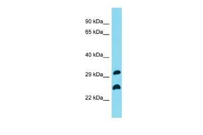 Western Blot: RyDEN Antibody [NBP2-83487]