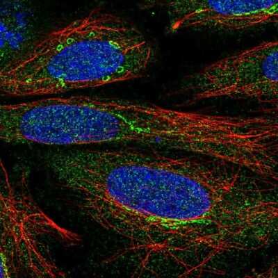 Immunocytochemistry/ Immunofluorescence: Ryanodine Receptor 1 Antibody [NBP2-33785]
