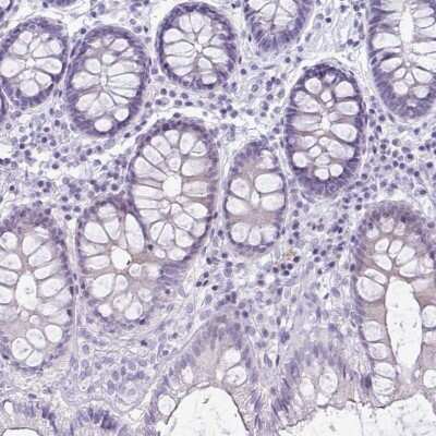 Immunohistochemistry-Paraffin: Ryanodine Receptor 1 Antibody [NBP2-33785]
