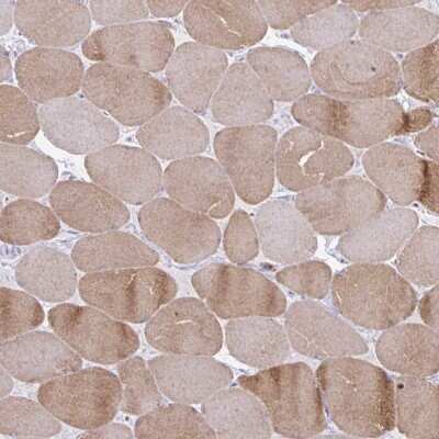 Immunohistochemistry-Paraffin: Ryanodine Receptor 1 Antibody [NBP2-33785]