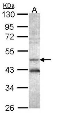Western Blot: Adenosylhomocysteinase/AHCY Antibody [NBP2-20246]