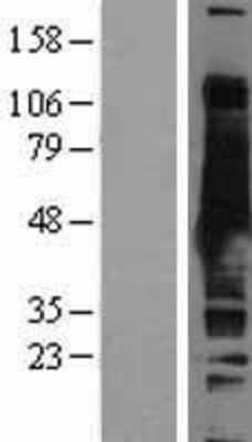 Western Blot: Adenosylhomocysteinase/AHCY Overexpression Lysate [NBL1-07402]