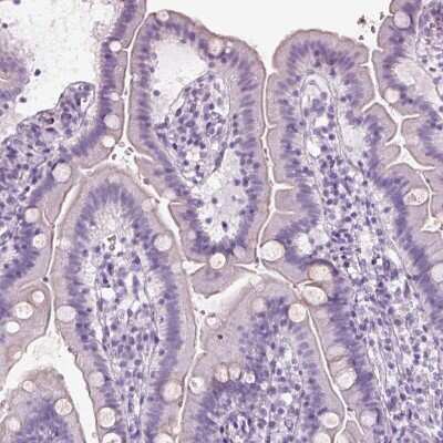 Immunohistochemistry-Paraffin: S-arrestin Antibody [NBP2-55126]