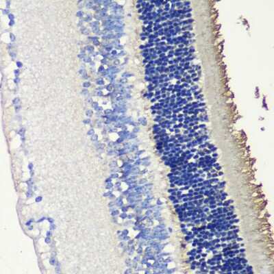 Immunohistochemistry-Paraffin: S-arrestin Antibody - Azide and BSA Free [NBP2-94241]