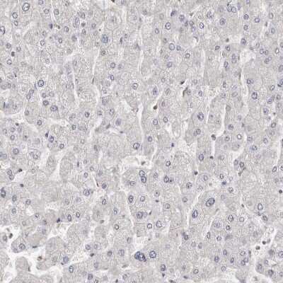 Immunohistochemistry-Paraffin: S100 calcium binding protein A14 Antibody [NBP1-90000]
