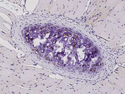 Immunohistochemistry-Paraffin: S100A1 Antibody (004) [NBP2-90503]