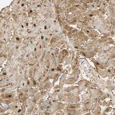 Immunohistochemistry-Paraffin: S100A1 Antibody [NBP1-87103]