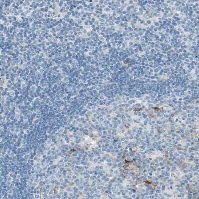 Immunohistochemistry-Paraffin: S100A1 Antibody [NBP1-87103]