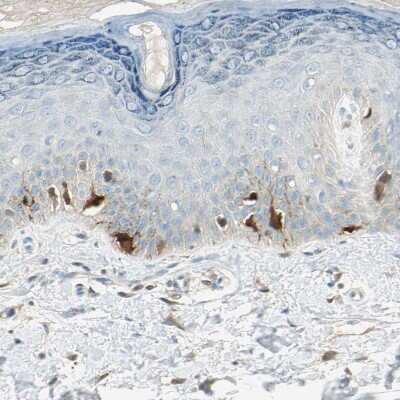 Immunohistochemistry-Paraffin: S100A1 Antibody [NBP1-87103]