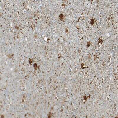 Immunohistochemistry-Paraffin: S100A1 Antibody [NBP1-87103]