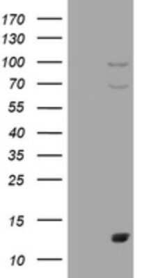 Western Blot: S100A1 Antibody (OTI6G4)Azide and BSA Free [NBP2-73967]