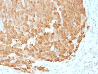 Immunohistochemistry-Paraffin: S100A1 Antibody (S100A1/1942) - Azide and BSA Free [NBP2-47924]