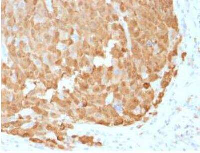 Immunohistochemistry-Paraffin: S100A1 Antibody (S100A1/1942) [NBP2-59615]