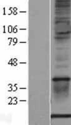 Western Blot: S100A1 Overexpression Lysate [NBL1-15647]