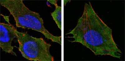 Immunocytochemistry/ Immunofluorescence: S100A10 Antibody (4E7E10) - BSA Free [NBP1-47368]