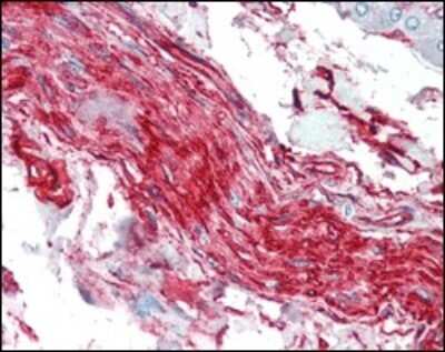 Immunohistochemistry-Paraffin: S100A10 Antibody (4E7E10) - BSA Free [NBP1-47368]