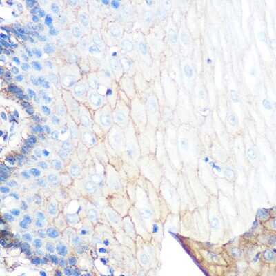 Immunohistochemistry-Paraffin: S100A10 Antibody (6X8F7) [NBP3-15467]