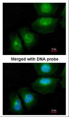 Immunocytochemistry/ Immunofluorescence: S100A11 Antibody [NBP1-32998]