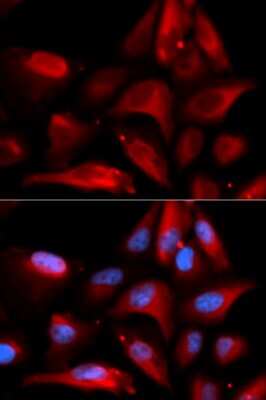 Immunocytochemistry/ Immunofluorescence: S100A11 Antibody - BSA Free [NBP3-03232]